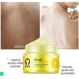 Lemon Cutin Gel Dead Skin Cleaning Pore Facial General Scrub - Phosgene