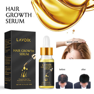 Damaged Hair Repair Women Men's Fast Hair Growth Essence Oil Anti-hair Loss Lotion - Phosgene