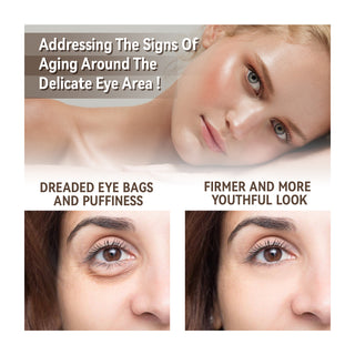 Moisturizing Eye Skin Care - Phosgene